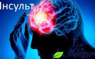 Ученые подсчитали, насколько алкоголь увеличивает риск инсульта и болезней сосудов