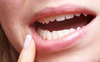 Почему обветриваются губы и как избавится от проблемы в домашних условиях