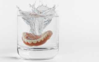 Одноэтапная имплантация зубов за 1 день!