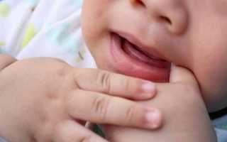 Отек десен у детей 2 лет