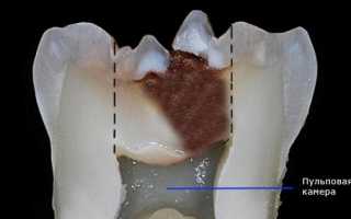 Депофорез: ударим электрическим током по кисте и гранулеме